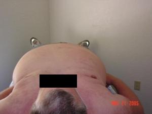 case 10, after treatment