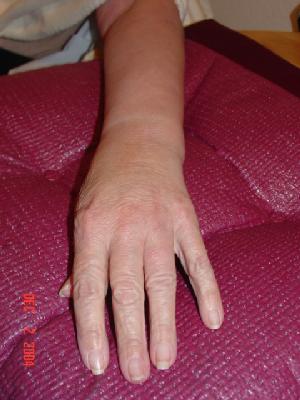 case 7, after treatment